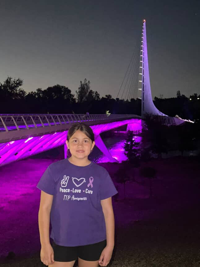 Sundial Bridge